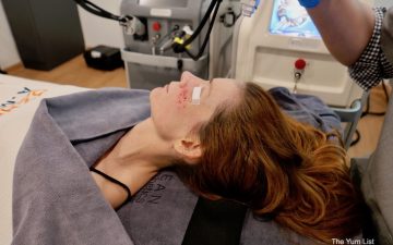 PicoWay & Fractional RF Micro-Needling