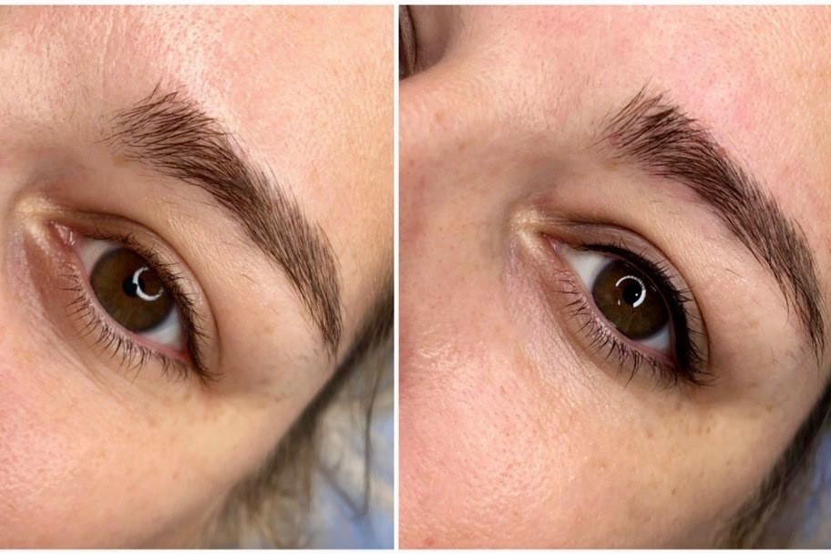 Tattoo Removal — Adorn Permanent Cosmetics & Microblading Oakland