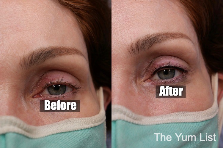 Know the Risks of Permanent Eyeliner on Your Eyelids  Intermountain Eye  Associates PC  Scranton  Bethlehem  Poconos  Lehigh Valley   Ophthalmology Eye Emergencies Eye Surgery Uveitis Corneal Disease