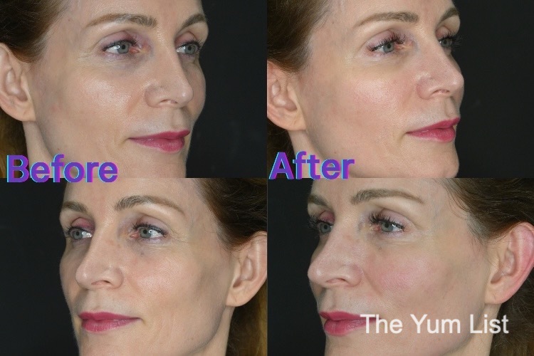 K-Whitening KL Kaiteki Clinic