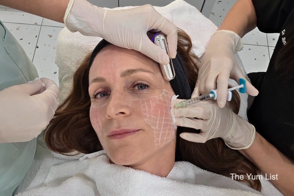 SKINVIVE Procedure
