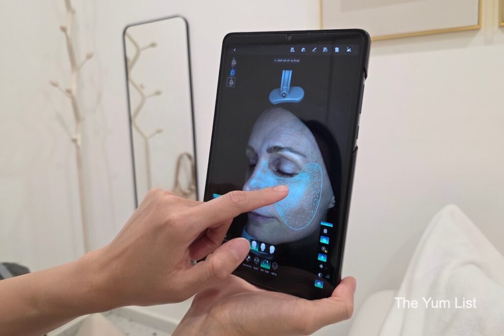 My Skin is Analysed Pre-treatment